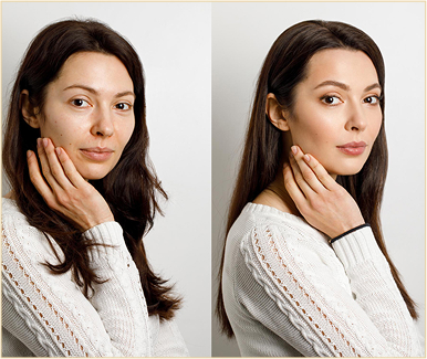 Botox Treatment Benefits Of Botox01