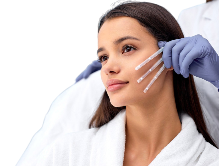 Chemical Peels Main Banner Img