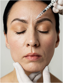 Microneedling Benefit Of Fabral02